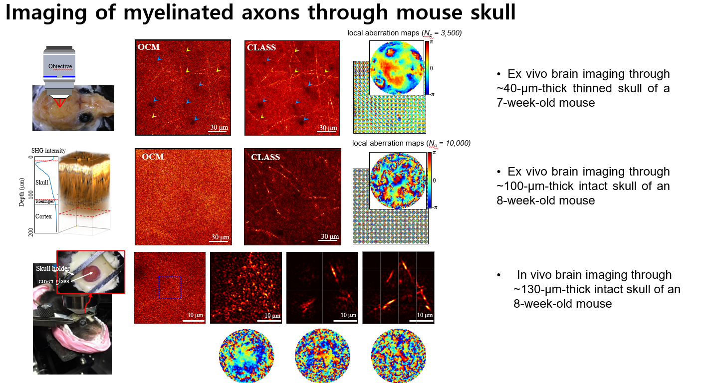Laser-scanning reflection-matrix microscopy for myelin imaging through intact mouse skull